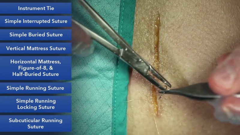 техника наложения швов от известного пластического хирурга - Michael R. Zenn, M.D.