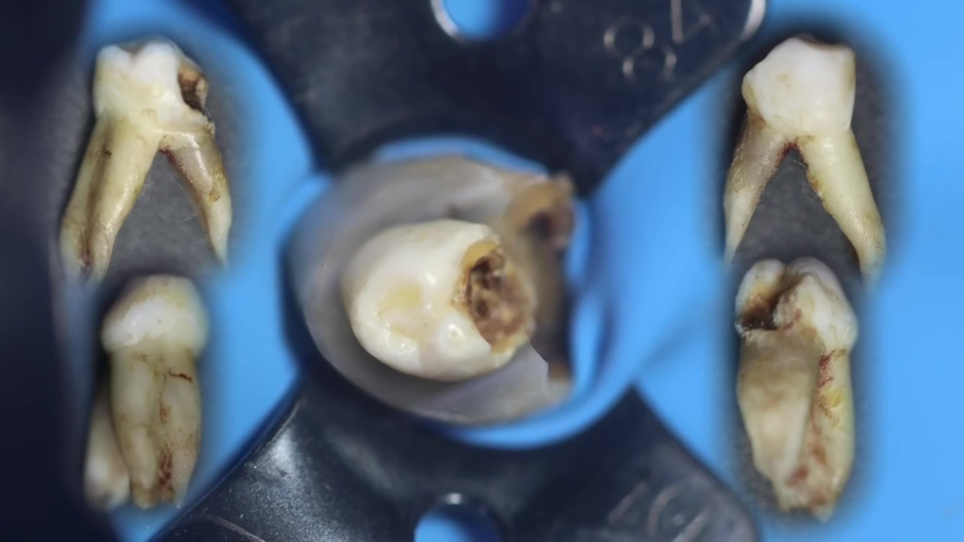 Эндодонтия