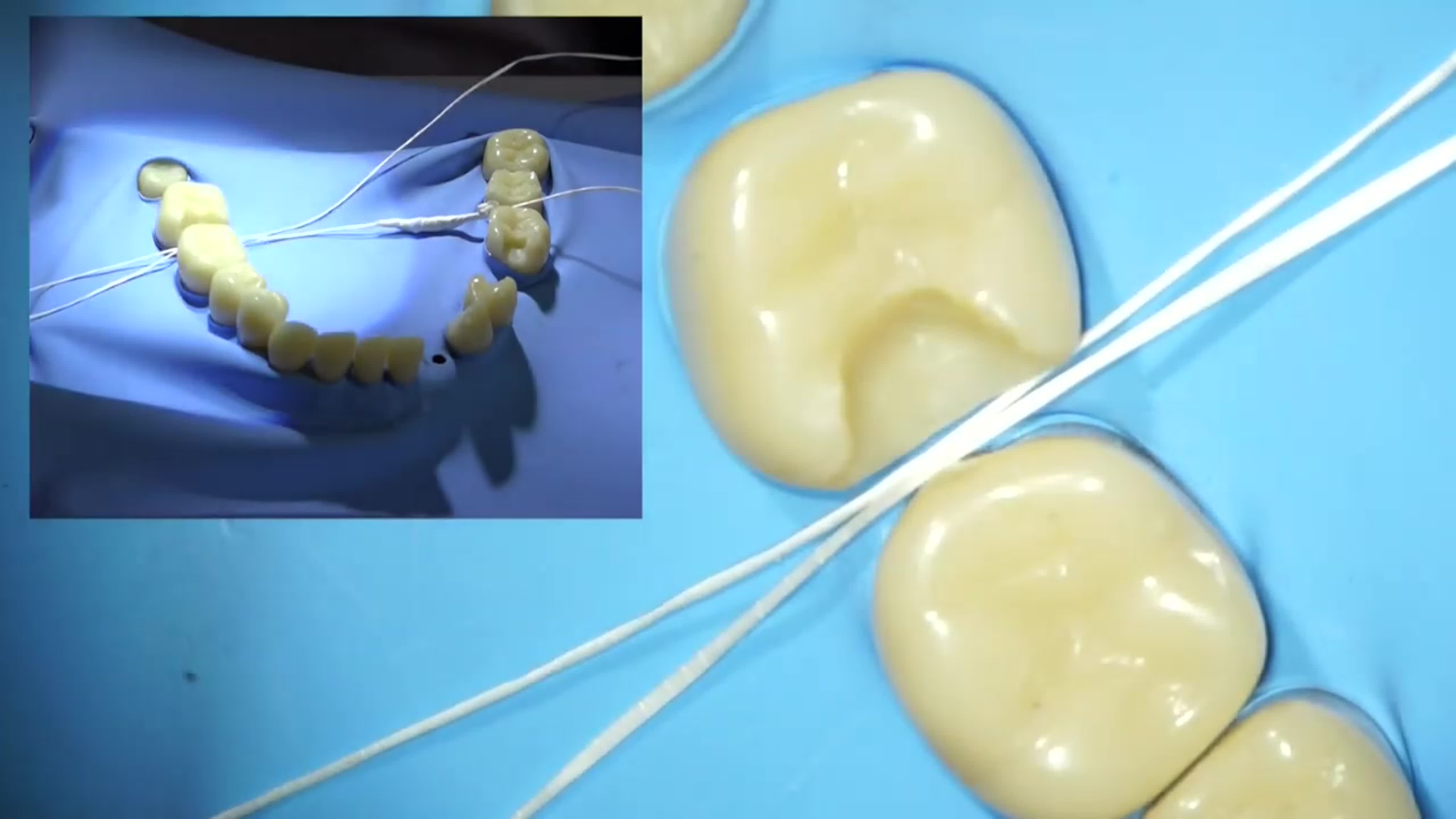 Изоляция рабочего поля