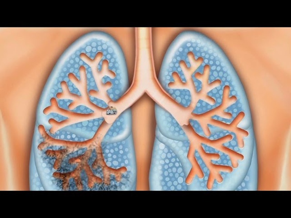 Строение человека