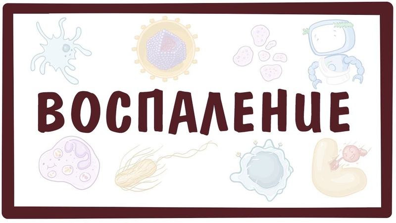 Воспаление