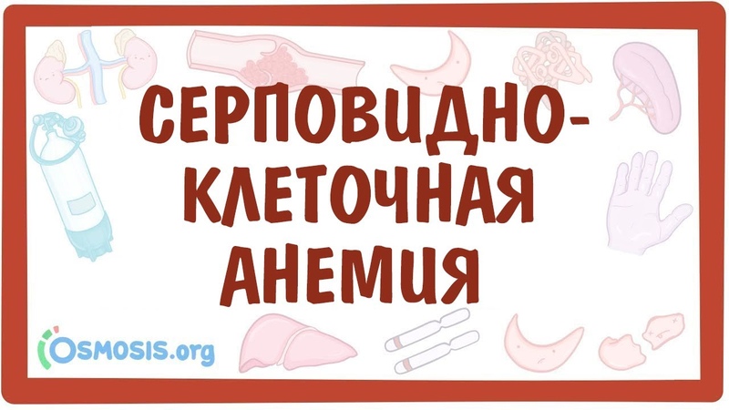 Гемолитические анемии