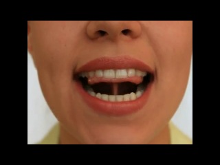 Логоудаленка (логопедия )